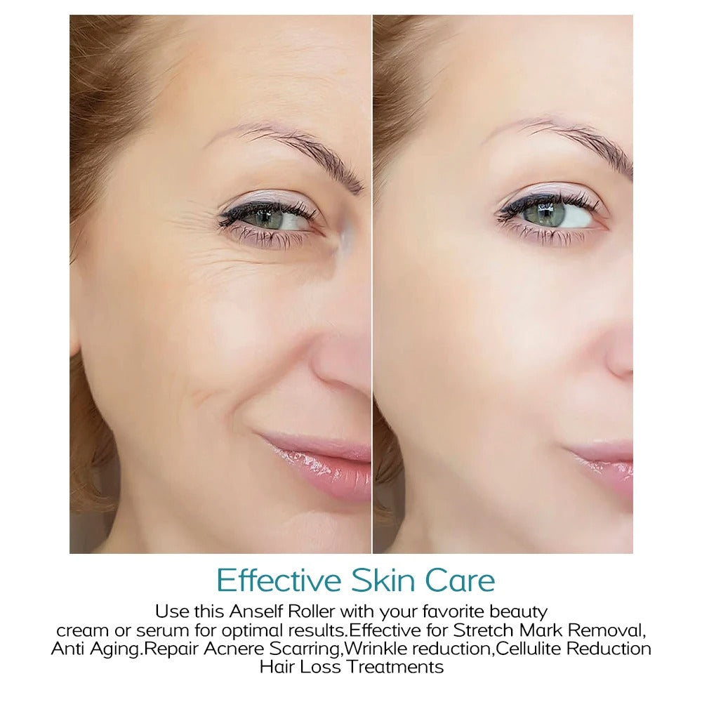 Microneedle Derma Roller – Glow, Smooth & Rejuvenate